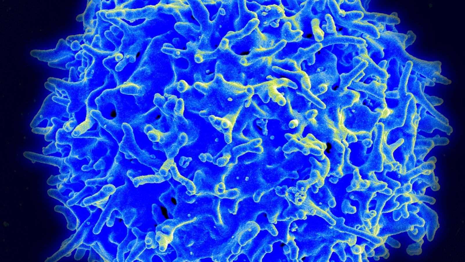Healthy Human T Cell by Wikipedia