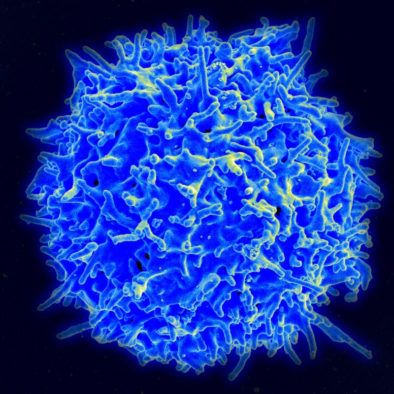 Healthy Human T Cell by Wikipedia