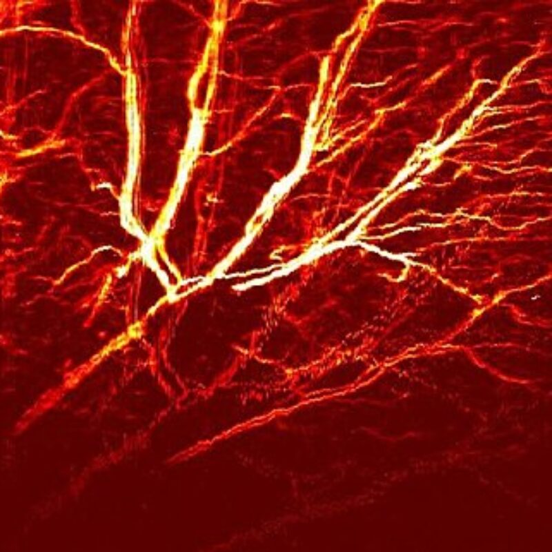 Mouse ear vasculature imaged using OR-PAM at 532 nm