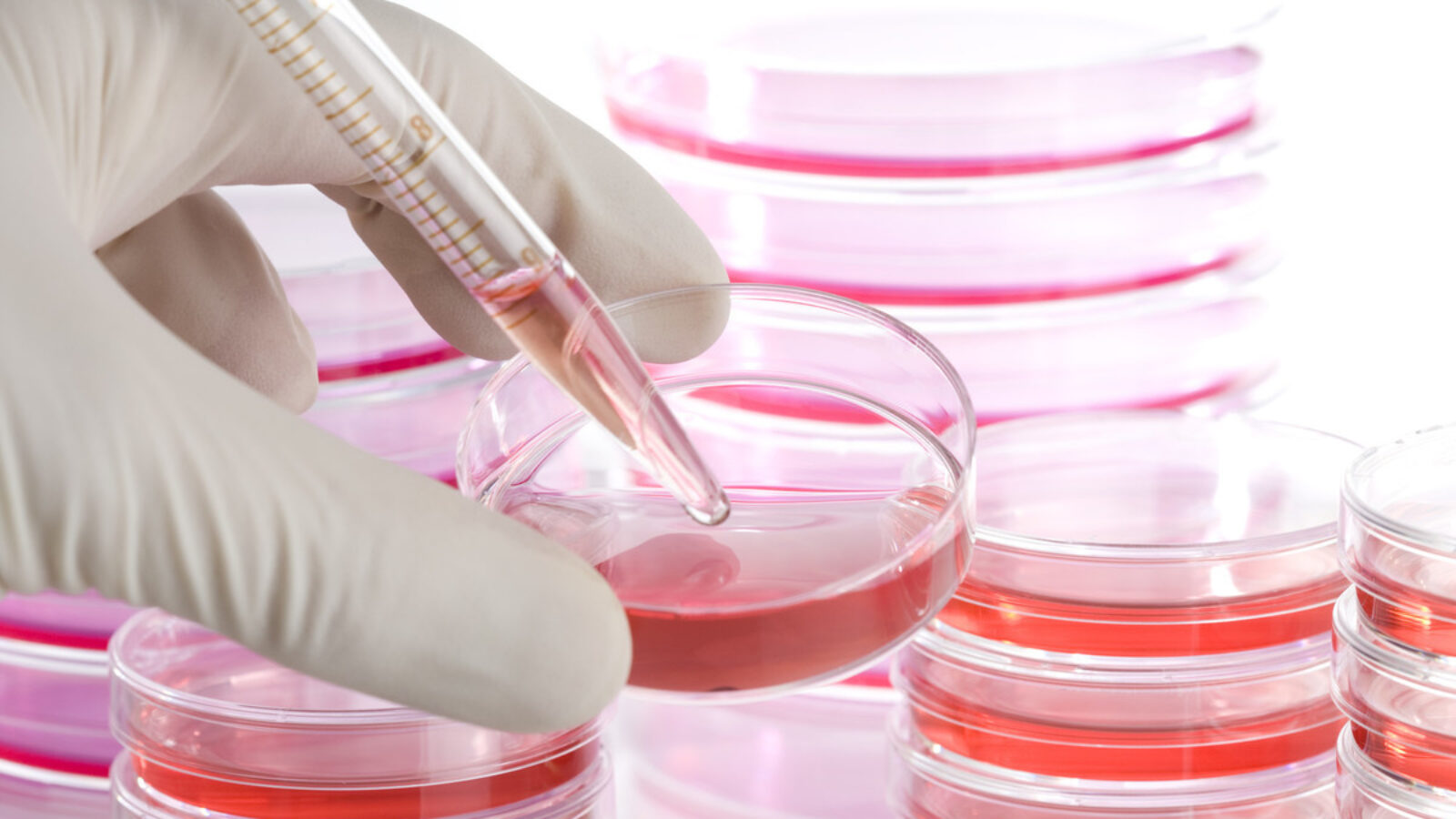 The picture shows hand holding petri dishes with a red liquid. This shall illustrate the cultivation of cells in order to develop personalized treatment in cancer