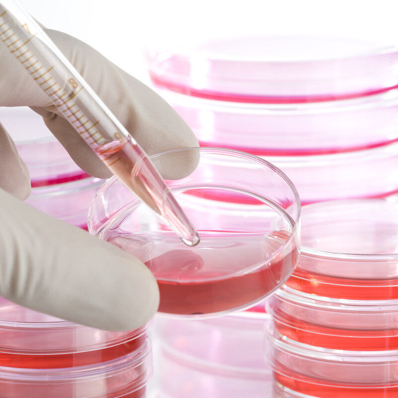 The picture shows hand holding petri dishes with a red liquid. This shall illustrate the cultivation of cells in order to develop personalized treatment in cancer